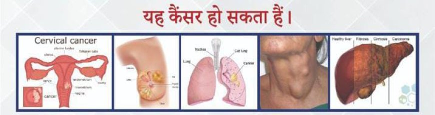 निशुल्क कैंसर जांच एवं परामर्श शिविर सतीश यादव
