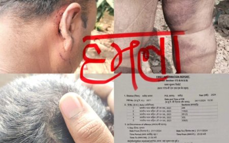 क्या अधिकारी के संरक्षण में पल रहे गुण्डों ने पत्रकार पर किया जानलेवा हमला…? रुपये भी लूटे, थाने में मामला दर्ज..!