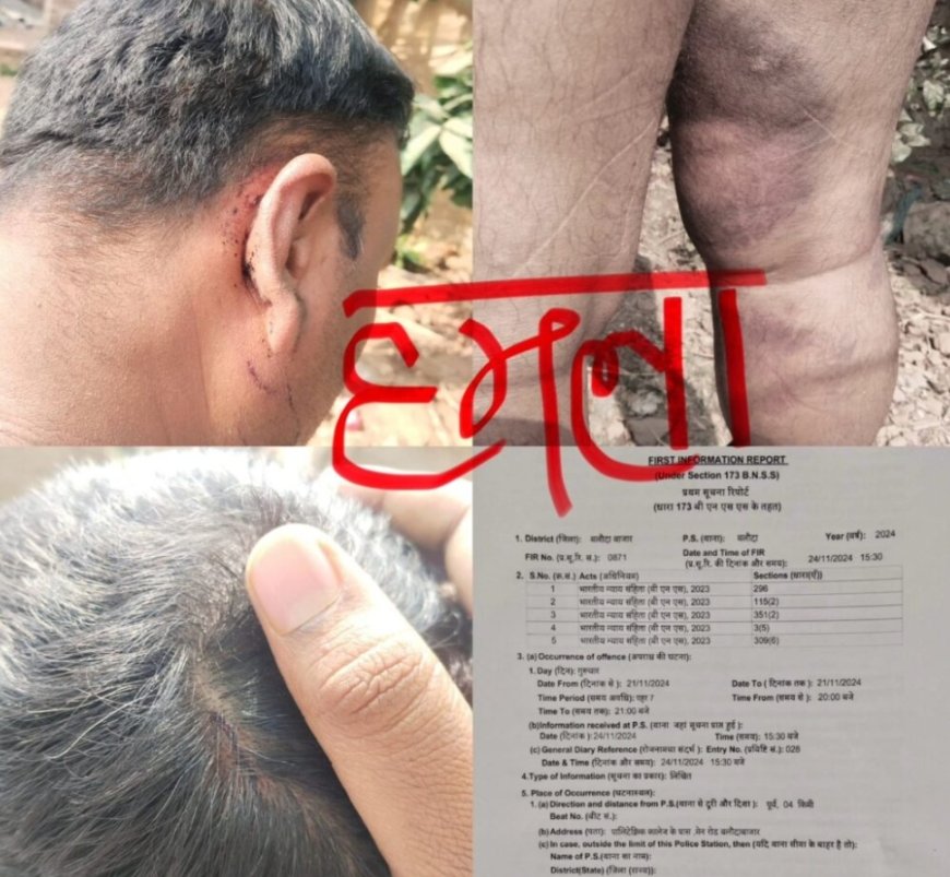 क्या अधिकारी के संरक्षण में पल रहे गुण्डों ने पत्रकार पर किया जानलेवा हमला…? रुपये भी लूटे, थाने में मामला दर्ज..!
