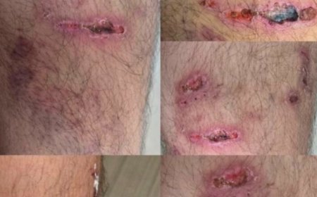 हरविलास अग्रवाल ने कंपनी की सुरक्षा के लिए विरोध किया तो उद्योगपति और पुत्र पर हिंसक हमला.. बमुश्किल बची जान, रायपुर में 5 लोगों पर FIR दर्ज